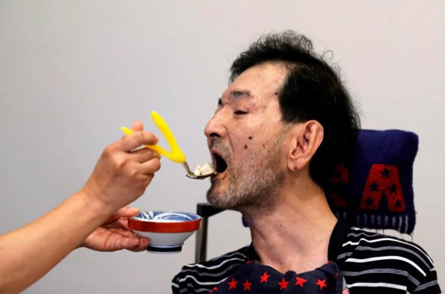 Nạn nhân nhiễm độc thủy ngân